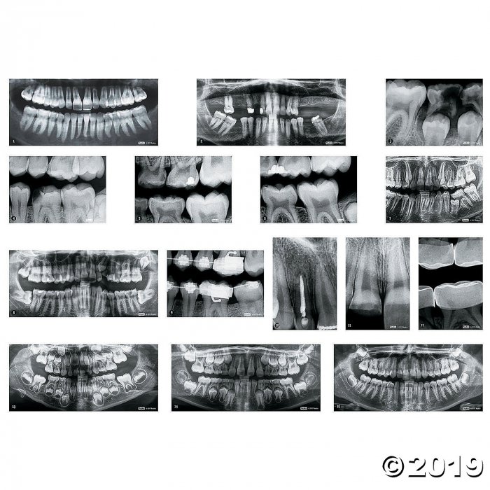 Dental Xrays (1 Piece(s))